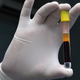 A health care worker in Iraq holding up a blood sample taken from a recovered covid-19 patient.